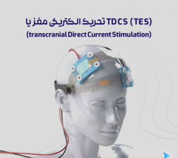 TDCS