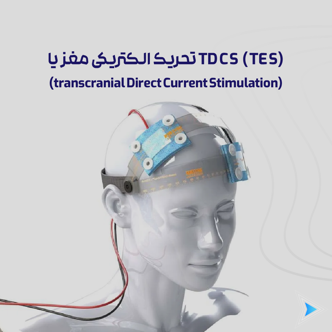 درمان با TDCS در مشهد