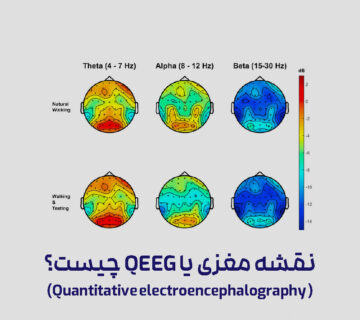نقشه مغزی QEEG