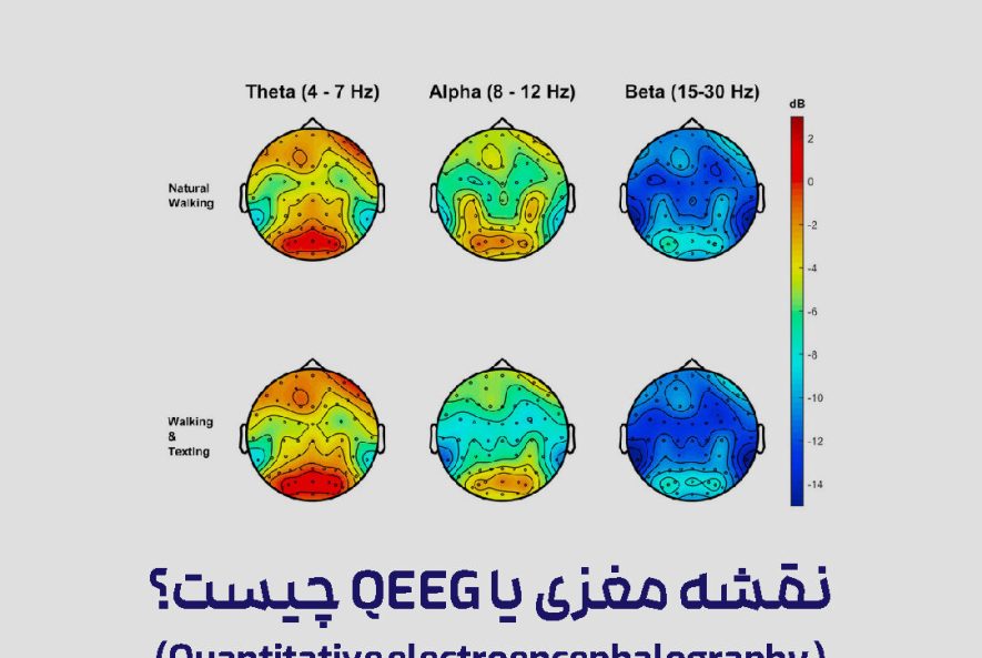 نقشه مغزی QEEG