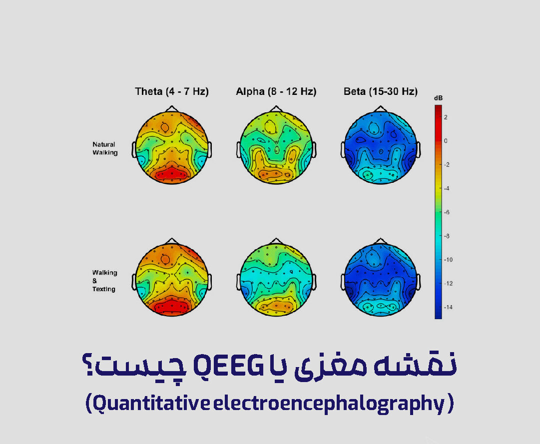 نقشه مغزی QEEG