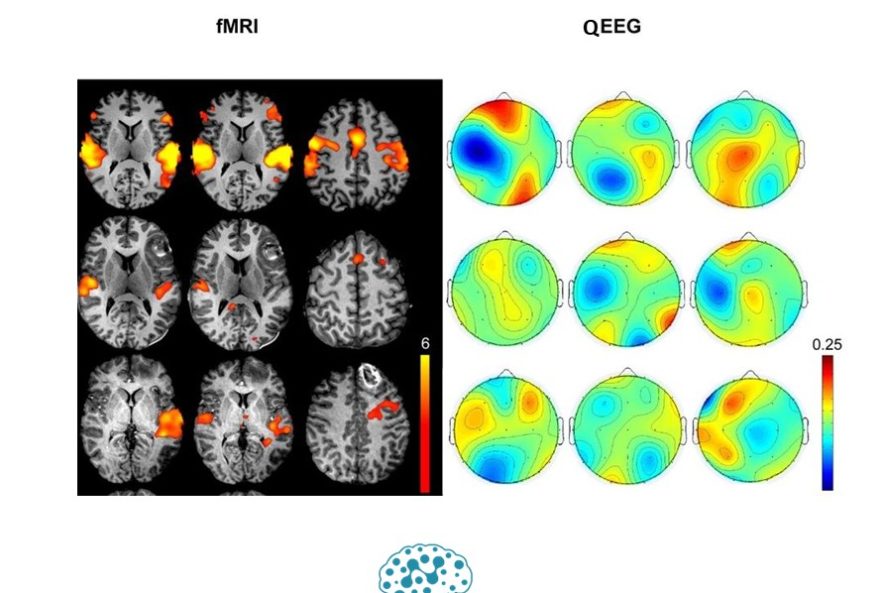 تفاوت QEEG و FMRI چیست؟