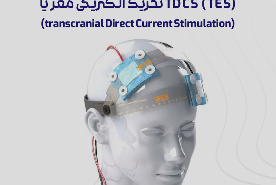 درمان با TDCS در مشهد