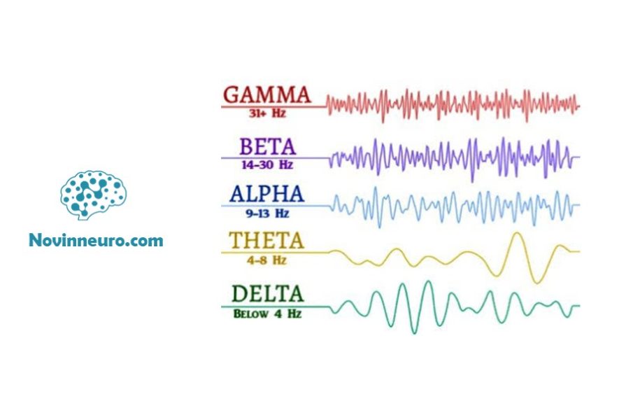 انواع امواج مغزی